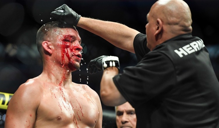 UFC: la blessure impressionnante de Nate Diaz après sa défaite face à Masvidal