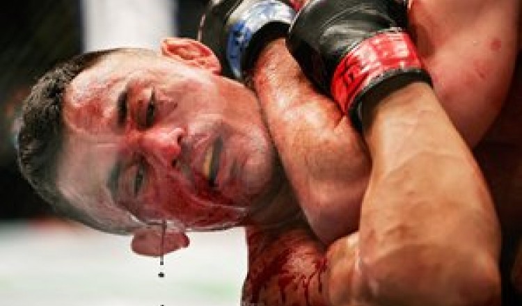 VIDEO. MMA : "Ce 'sport' de m*rde est autorisé"... Violentes critiques à propos d'un combat qui s'est terminé dans un bain de sang