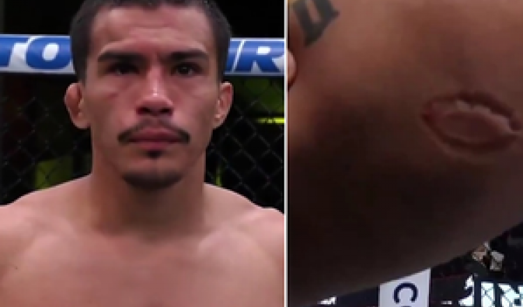 VIDEO. MMA : "Oh mon Dieu !" Un combattant mord violemment son adversaire en plein match, il est disqualifié et même exclu de l’UFC
